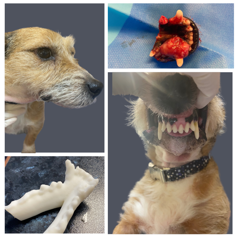 Maxillofacial surgery on mandible