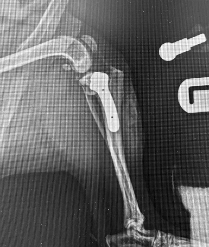 Orthopaedic Surgery Cruciate Ligament Disease Orthopaedic Surgery Cruciate Ligament Disease