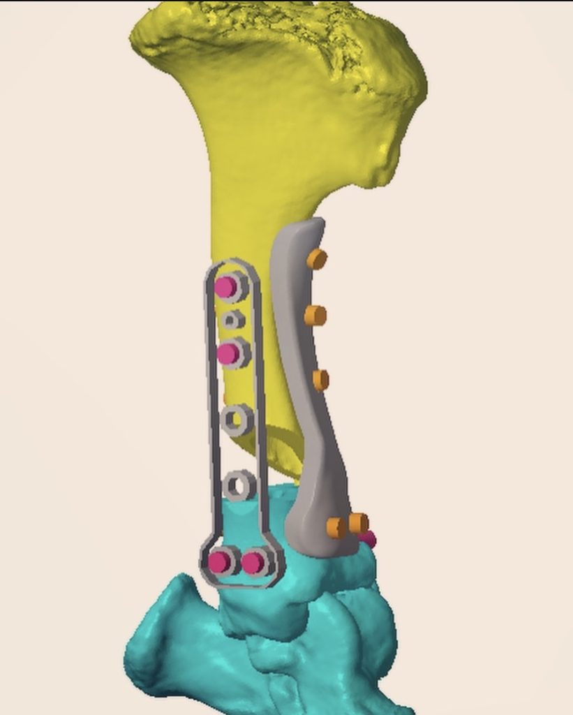 Orthopaedic Surgery angular Limb Deformaties Angular Limb Deformaties