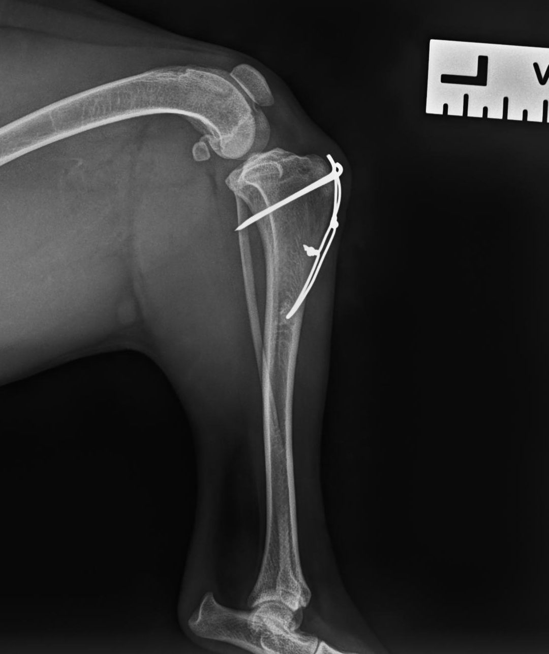 Orthopaedic Surgery Patella Luxation Orthopaedic Surgery Patella Luxation